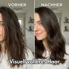 MELAO Haarwachstums-Serum Roll-on (50ml) | Anti-Haarausfall & Kopfhaut-Massage | Wurzelstärkung & Dichteres Haar | Für Damen & Herren | Präzise Anwendung